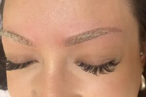 Rimozione tatuaggi e bellezza Volketswil Zurigo